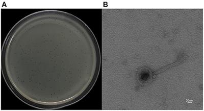 Isolation, Genomic Analysis, and Preliminary Application of a Bovine Klebsiella pneumoniae Bacteriophage vB_Kpn_B01